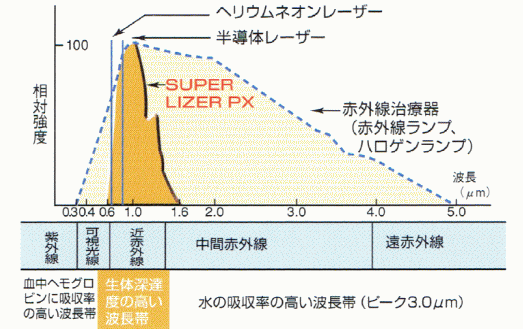 スーパーライザーの周波数帯解説の図